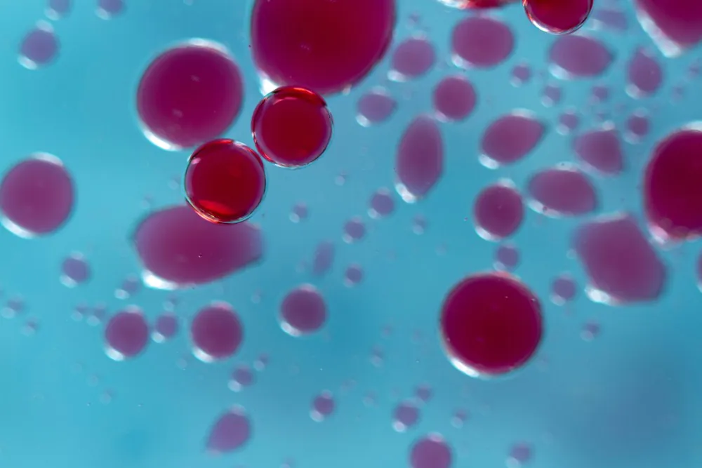More funding announced for vital leukaemia research