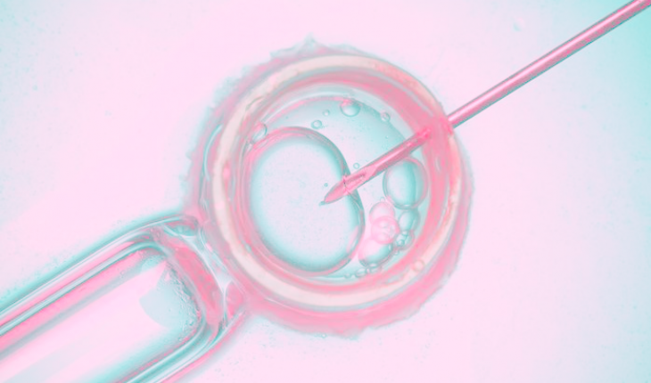IVF