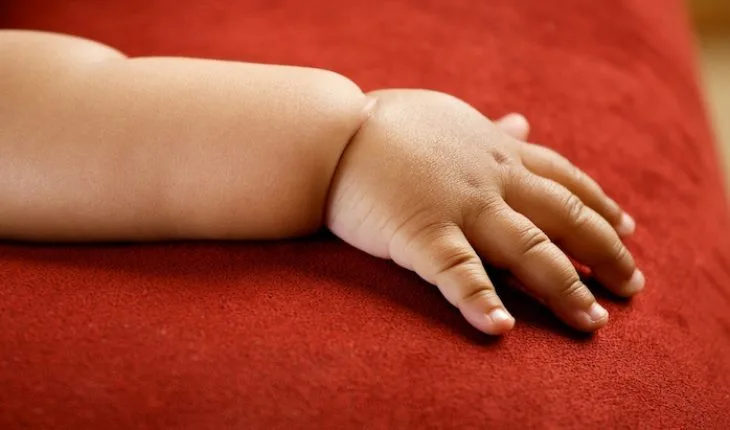 gestational diabetes