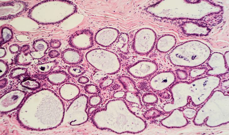The Hippocratic Post - biopsy