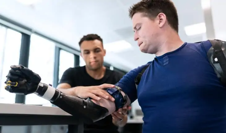 Engineer Fitting Prosthetic Arm