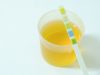 All about cystitis