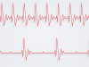 Heart Rhythm Congress in 12th year