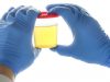 How to lessen contamination rates in urine samples