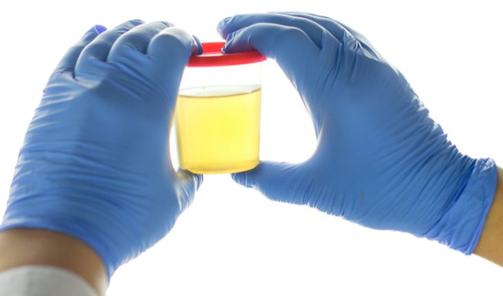 urine