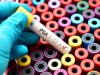 Prostate cancer: immunotherapy offers hope