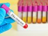 New vaccines research aims to tackle Ebola, Plague and Zika