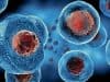 Stem cell research for ‘untreatable’ STDs