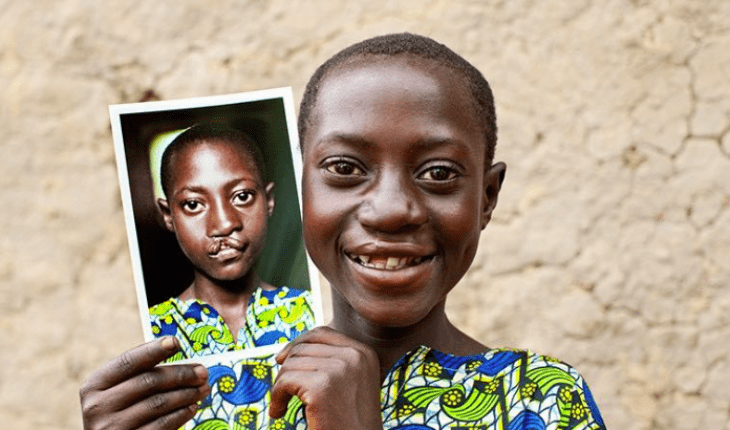Operation Smile - The Hippocratic Post