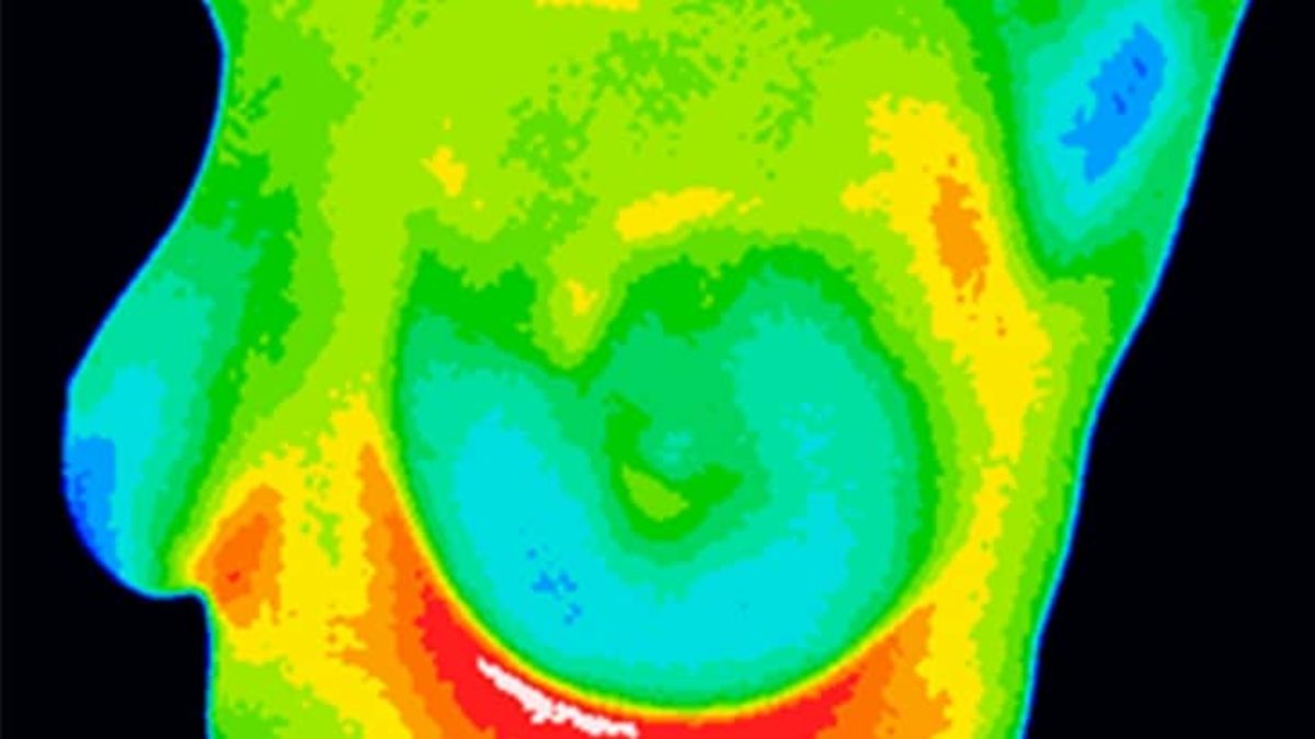 Тепловизионный комплекс термограмма тс. Термограмма тепловизора. Термограмма это. Термограмма руки. Инфракрасное излучение термография.