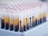UK biobank boosts COVID-19 sample availability