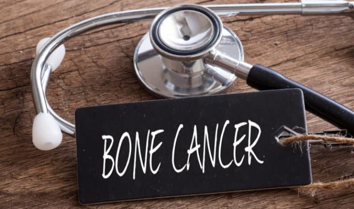 bone cancer
