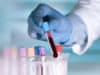 How blood and wealth can predict future disability