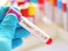Winning against dengue in Indonesia