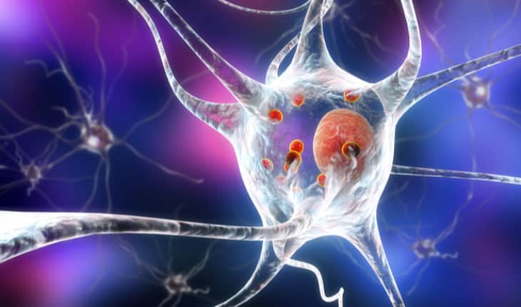 Parkinson's Disease