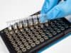 Early blood serum profile changes can identify alcohol dependence
