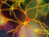 Neurological consequences of COVID-19: The ‘Silent Wave’