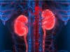 Stroke prevention in dialysis patients