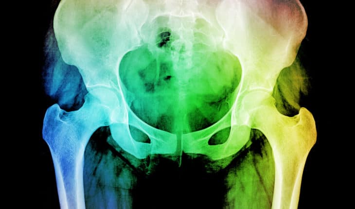 gaps in radiotherapy follow up care
