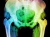 Massive gaps in radiotherapy follow up care