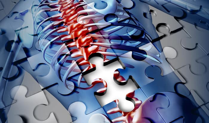Spinal