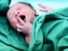 Detailed insight into new born babies’ lungs at birth