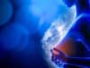 ProFound AI May Reduce Interval Breast Cancer Rates