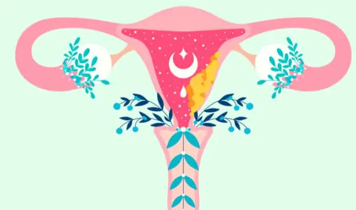 endometrial cancer