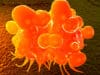 Increasing sensitivity of bowel cancer test