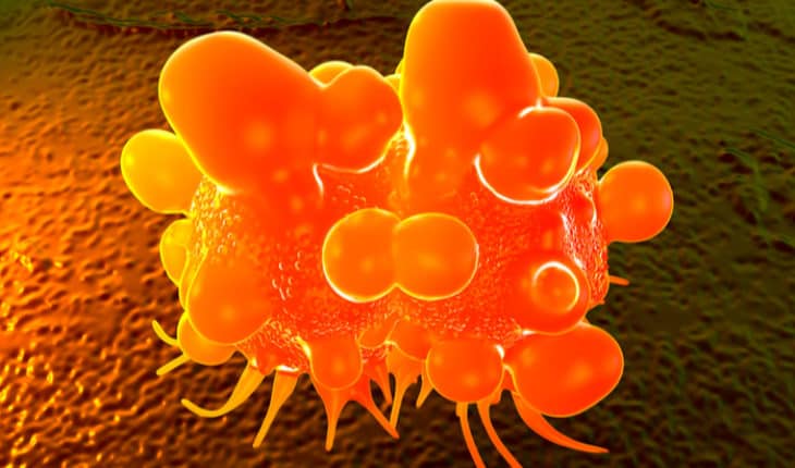 Bowel Cancer test