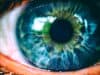 New NHS approach for people with eye disease