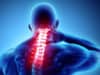 Genetics, brain structure and chronic pain