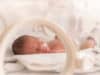 Pioneering treatment for premature infants with chronic lung disease