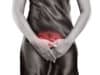 Endometriosis under the spotlight
