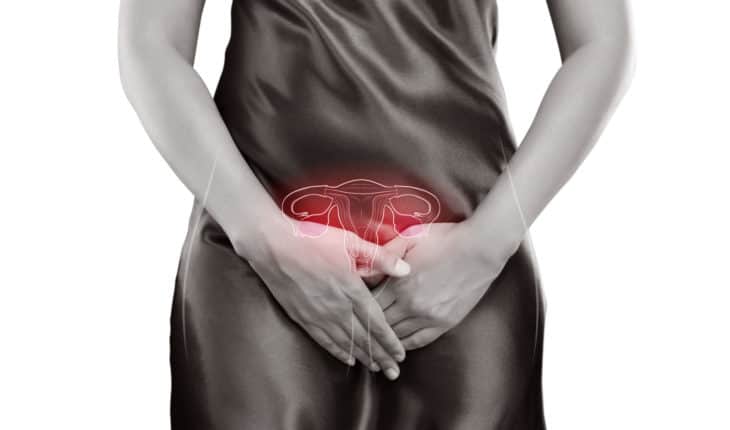 endometriosis
