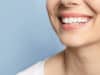 An implant dentist answers the most Googled questions