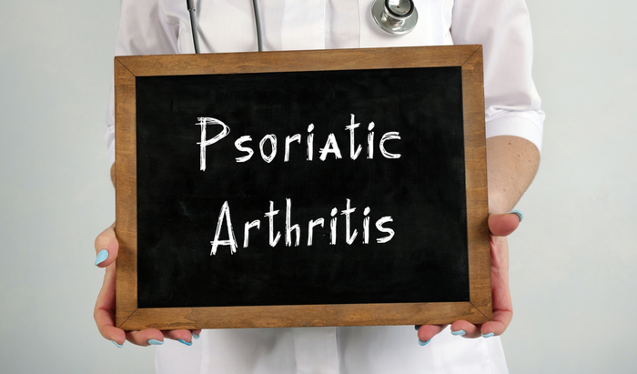 Psoriasis