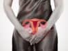 Locally advanced cervical cancer: Better odds using personalized brachytherapy