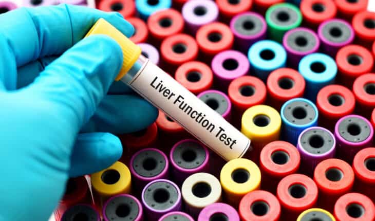 Non-Alcoholic Fatty Liver Disease