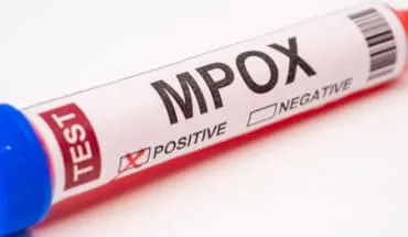 mpox