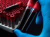 New HIV and Hepatitis cases identified