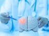 New materials could lead to implantable treatments for epilepsy