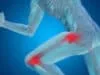 Avoiding surgery by healing ACL rupture