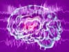 New insights on why epilepsy develops