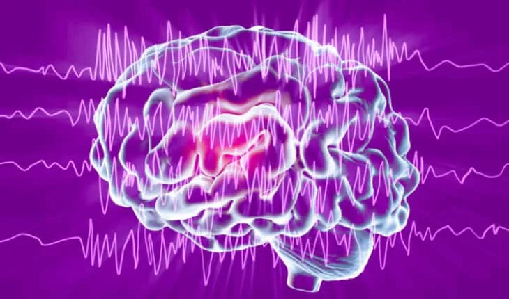 why epilepsy