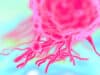 Breakthrough in metastatic breast cancer research