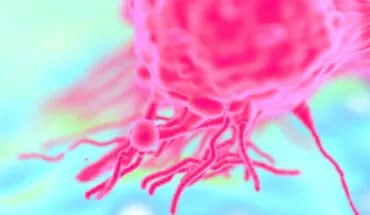 metastatic breast cancer