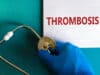 Prediction of the risk of recurrence of venous thrombosis
