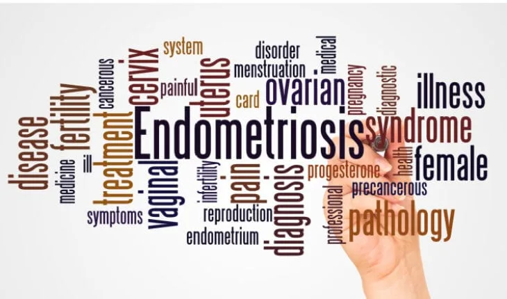 endometriosis diagnosis
