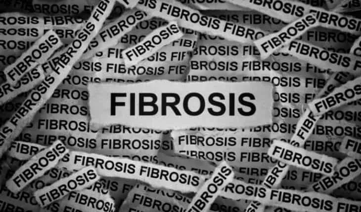 fibrosis